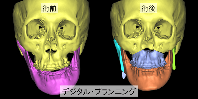 デジタル。プランニング
